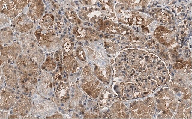 Anti-FTO Antibody, clone 4B21 ZooMAb<sup>®</sup> Rabbit Monoclonal