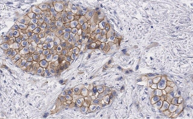 Anti-Glypican-1 Antibody, clone 1J4, ZooMAb<sup>®</sup> Rabbit Monoclonal