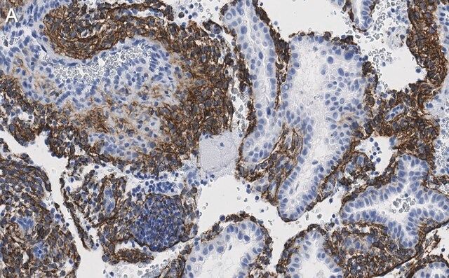 Anti-Fibrillin-1 Antibody, clone 6C19 ZooMAb<sup>®</sup> Rabbit Monoclonal