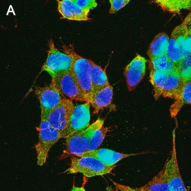 Anti-GABA A Receptor 1 Antibody, clone 3H10 ZooMAb<sup>®</sup> Rabbit Monoclonal