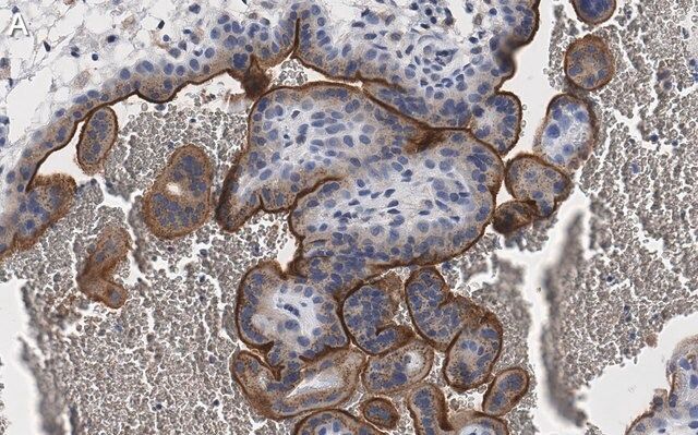 Anti-eNOS Antibody, clone 2F12 ZooMAb<sup>®</sup> Rabbit Monoclonal