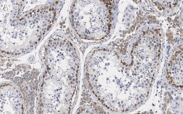 Anti-FMR1 (C-terminal) Antibody, clone 2B16 ZooMAb<sup>®</sup> Rabbit Monoclonal