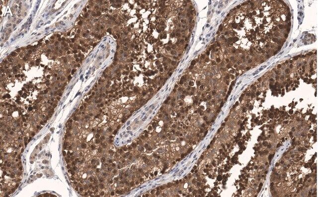 Anti-FKBP52 Antibody, clone 4H21 ZooMAb<sup>®</sup> Rabbit Monoclonal