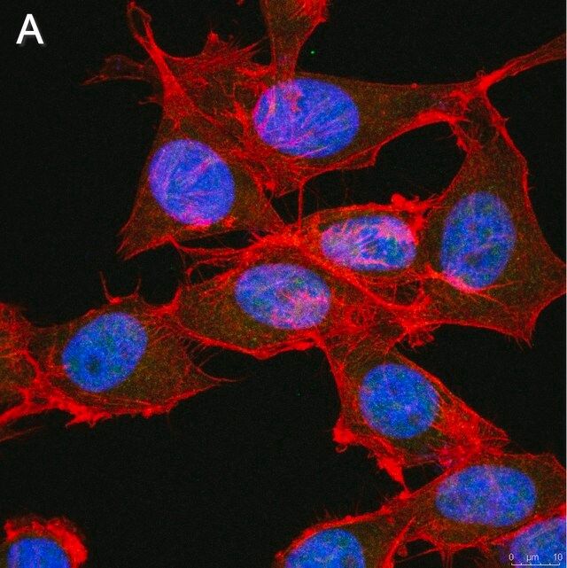 Anti-FoxP3 Antibody, clone 4J2 ZooMAb<sup>®</sup> Rabbit Monoclonal