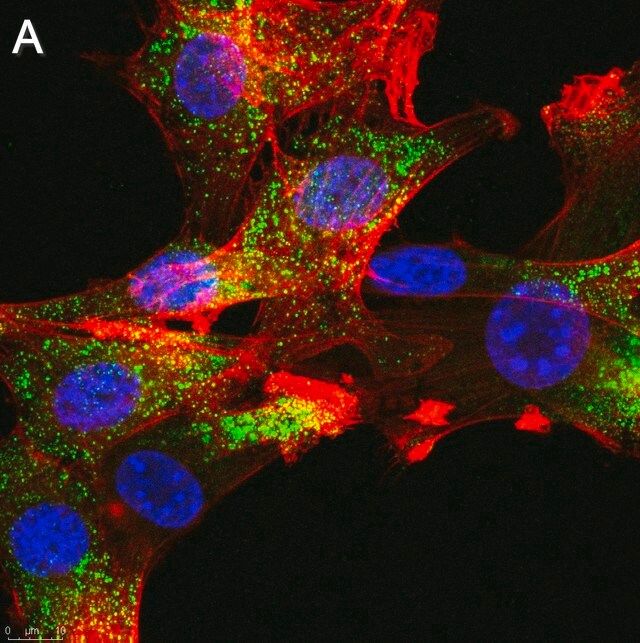 Anti-FGFR1 Antibody, clone 2J21 ZooMAb<sup>®</sup> Rabbit Monoclonal