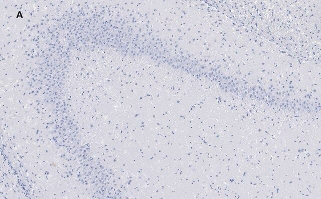 Anti-GluR2 Antibody, clone 1K4, ZooMAb<sup>®</sup> Rabbit Monoclonal