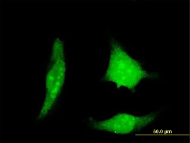 Monoclonal Anti-DSCR1 antibody produced in mouse