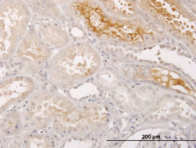 Monoclonal Anti-S100A5 antibody produced in mouse