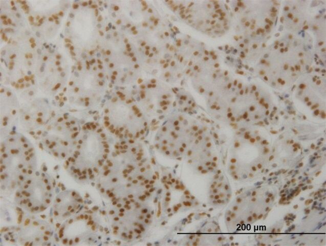 Monoclonal Anti-PPP3CA antibody produced in mouse