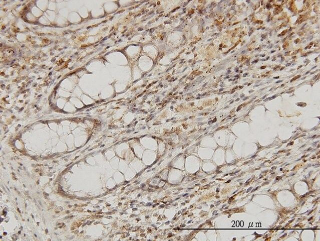 Monoclonal Anti-MAPRE2 antibody produced in mouse