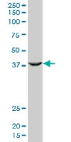 Monoclonal Anti-PCGF2 antibody produced in mouse