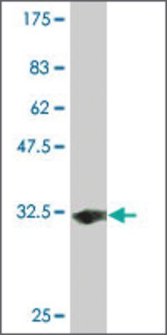 Monoclonal Anti-SLC35D2 antibody produced in mouse