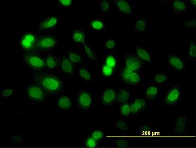 Monoclonal Anti-ZNF21 antibody produced in mouse