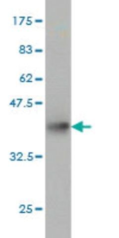 Monoclonal Anti-TTC8 antibody produced in mouse