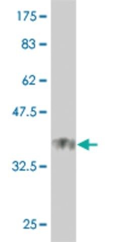 Monoclonal Anti-USP21 antibody produced in mouse