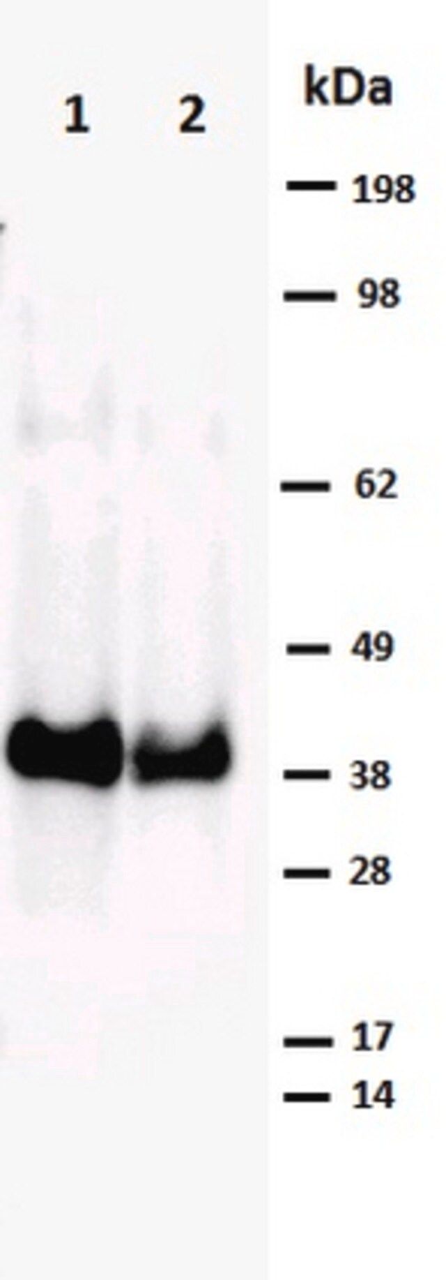 Anti-Cre Antibody