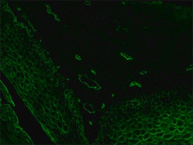 Anti-Lectin, <i>Ulex europaeus-I</i> antibody produced in rabbit