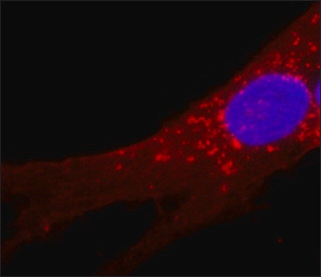 Monoclonal Anti-Fibroblast Surface Protein antibody produced in mouse