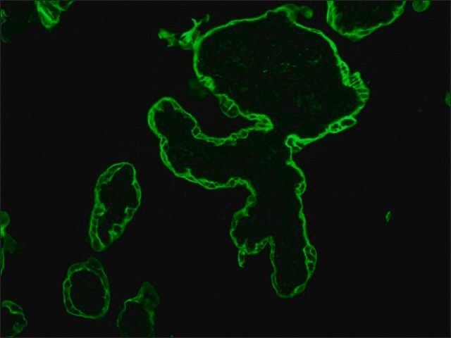 Monoclonal Anti-Cytokeratin Peptide 18 antibody produced in mouse