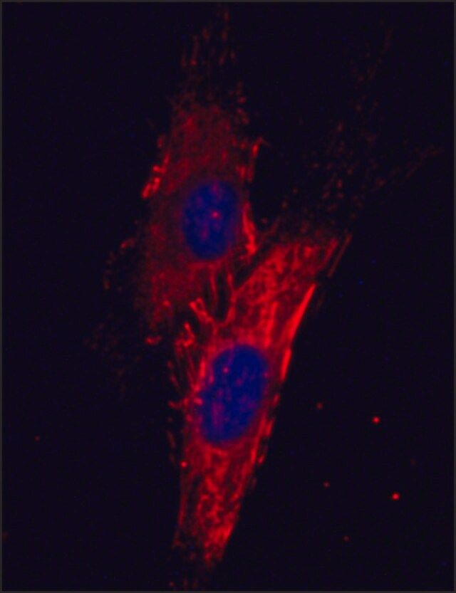 Monoclonal Anti-Fibronectin antibody produced in mouse