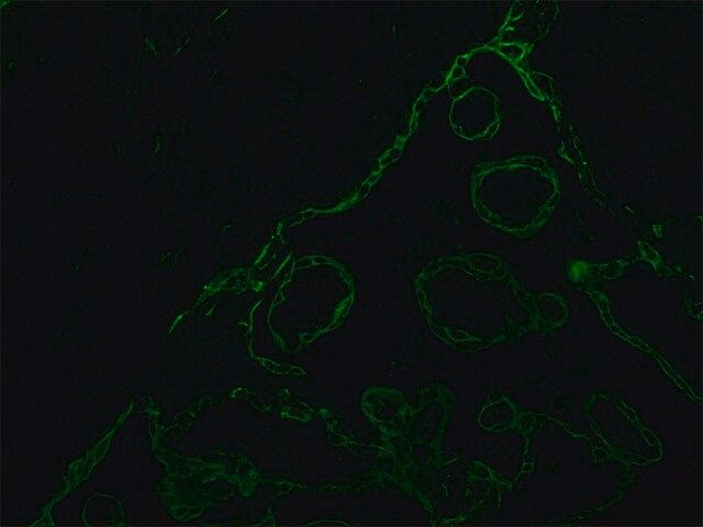 Monoclonal Anti-Cytokeratin Peptide 18 antibody produced in mouse