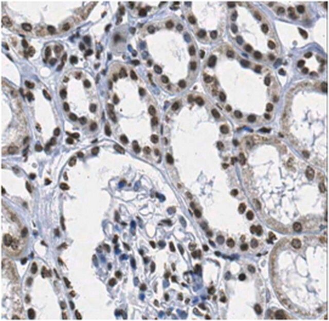 Anti-Polyhomeotic-like protein 2 Antibody (PHC2)