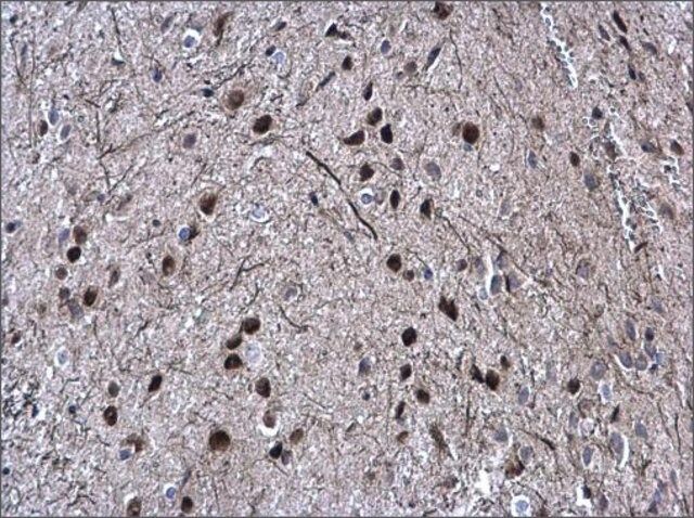 Anti-SOX2 antibody produced in rabbit