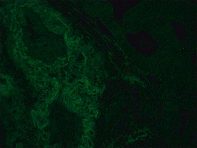 Monoclonal Anti-HLA Class I Antigen-FITC antibody produced in mouse