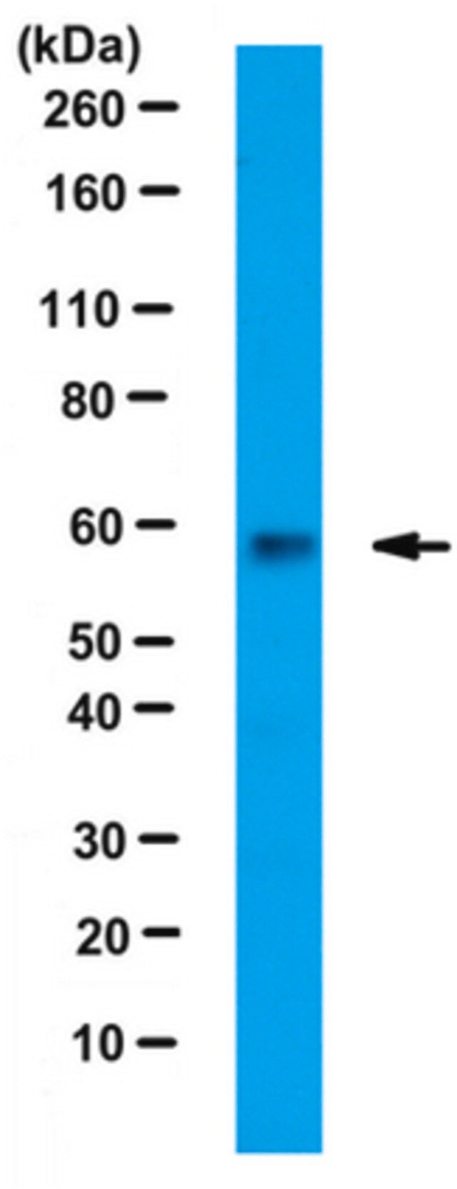 Anti-PKM1 Antibody