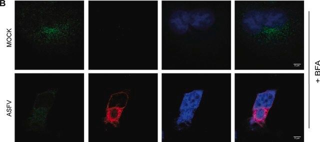 Monoclonal Anti--Adaptin antibody produced in mouse