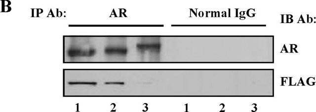 Anti-Androgen Receptor Antibody