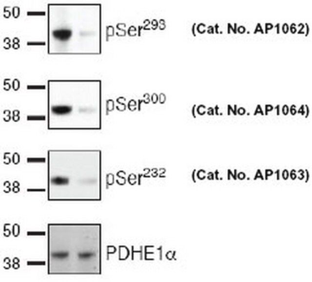 PhosphoDetect Anti-PDH-E1 (pSer<sup>2</sup><sup>3</sup><sup>2</sup>) Rabbit pAb