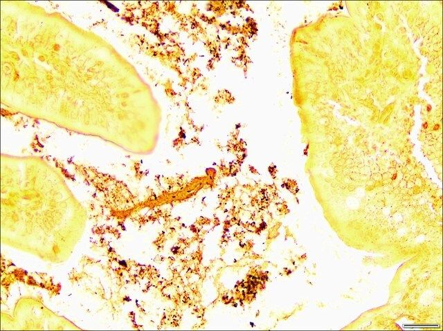 Helicobacter TISSUE-TROL<sup>TM</sup> Control Slides