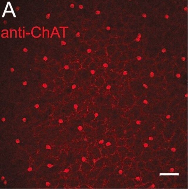 Anti-Choline Acetyltransferase Antibody