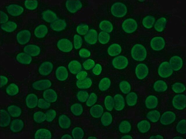 Anti-Human IgG (Fab specific)-FITC antibody produced in goat