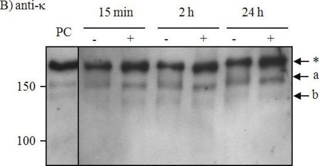 Anti-Human Kappa Light Chains (Bound and Free)-Peroxidase antibody produced in goat