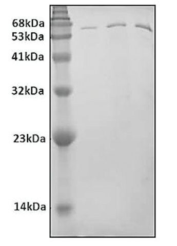 Nucleophosmin (hNPM) human