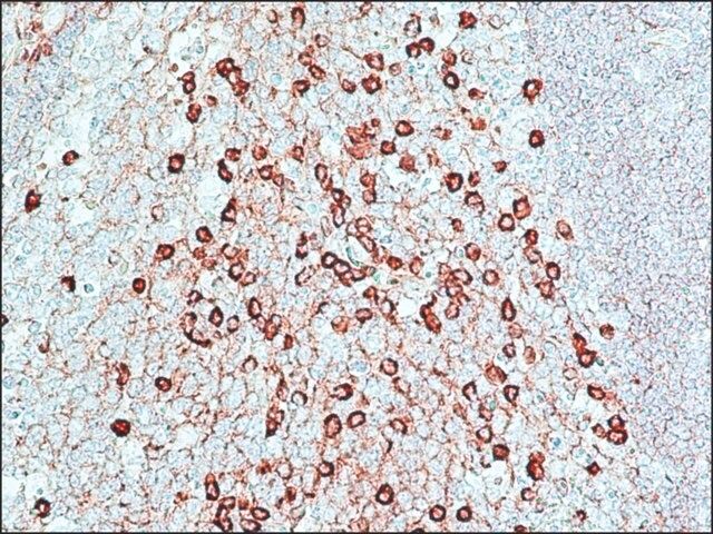 Peroxidase Anti-Peroxidase Soluble Complex antibody produced in rabbit