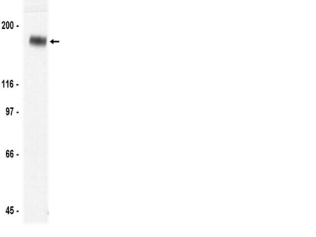 Anti-erbB-3/HER-3 Antibody, clone 2F12