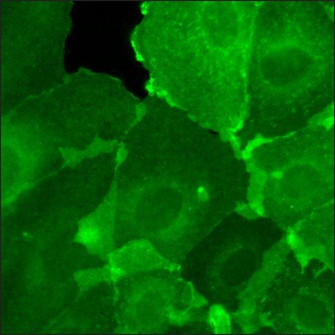 SKOV3 Cells GFP-HER2