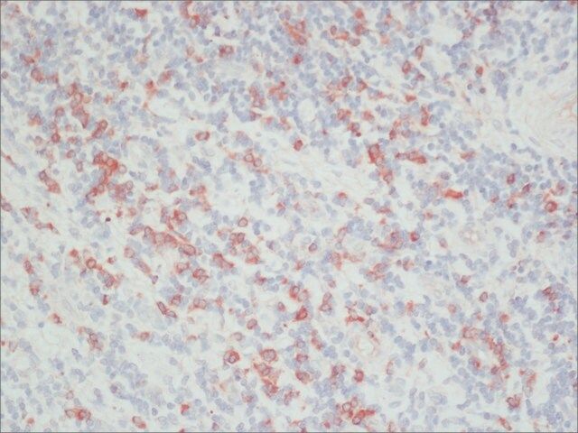 Anti-Rat IgG (whole molecule)-Peroxidase antibody produced in rabbit