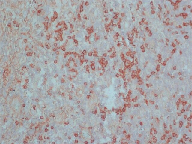 Anti-Rat IgG (whole molecule)-Peroxidase antibody produced in rabbit