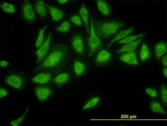 Monoclonal Anti-USP47 antibody produced in mouse