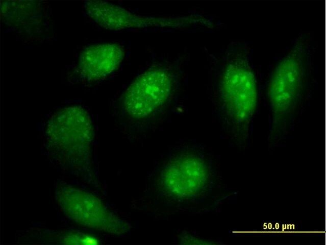 Monoclonal Anti-VIM antibody produced in mouse