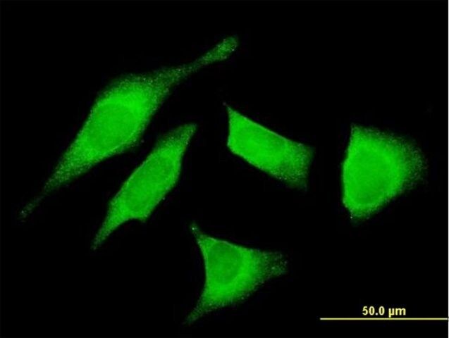 Monoclonal Anti-UTRN antibody produced in mouse