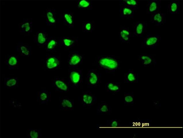 Monoclonal Anti-VPS25 antibody produced in mouse