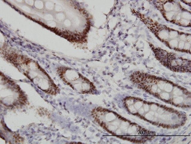 Monoclonal Anti-WDR4 antibody produced in mouse