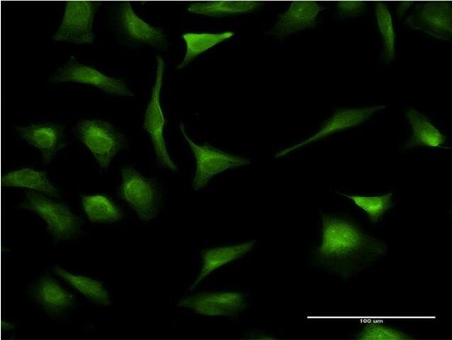 Monoclonal Anti-XBP1 antibody produced in mouse