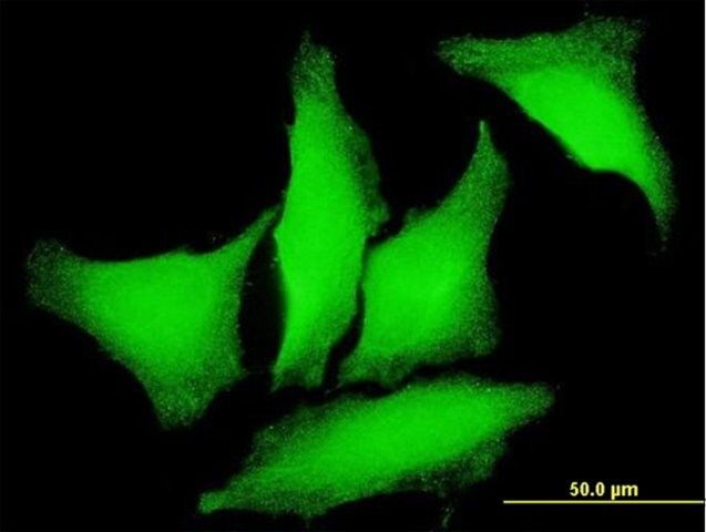 Monoclonal Anti-PKD2 antibody produced in mouse