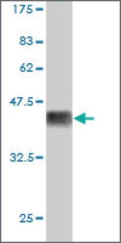 Monoclonal Anti-PLAGL1 antibody produced in mouse